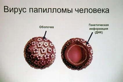Вірус папіломи людини при вагітності причини виникнення, вплив на плід, лікування (виховання) Вірус папіломи людини при вагітності причини виникнення, вплив на плід, лікування