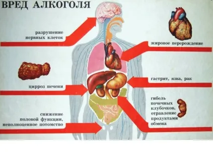Висновок із запою як позбутися від алкоголізму