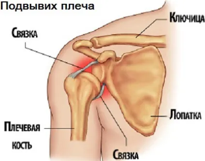 Вивих плечового суглоба симптоми, лікування і операція, вправи для реабілітації суглоба плеча (плечового) Вивих плечового суглоба симптоми, лікування і операція, вправи для реабілітації суглоба плеча
