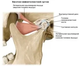 Запалення щелепного суглоба симптоми, лікування, до якого лікаря звернутися (суглоба) Запалення щелепного суглоба симптоми, лікування, до якого лікаря звернутися