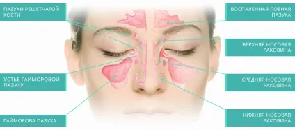 Захворювання дихальної системи види і особливості (захворювання) Захворювання дихальної системи види і особливості