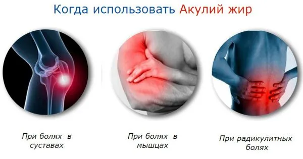 Акулячий жир в капсулах спосіб застосування і відгуки про результати (шкіри волосся нігтів) Акулячий жир в капсулах спосіб застосування і відгуки про результати