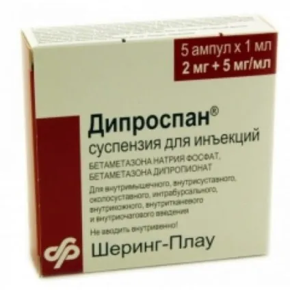 Артрит лучезапястного суглоба (лучезапястного) Артрит лучезапястного суглоба