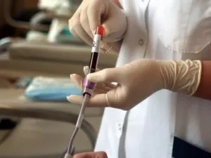 Анемія важкого ступеня як її лікувати (ступеня) Анемія важкого ступеня як її лікувати