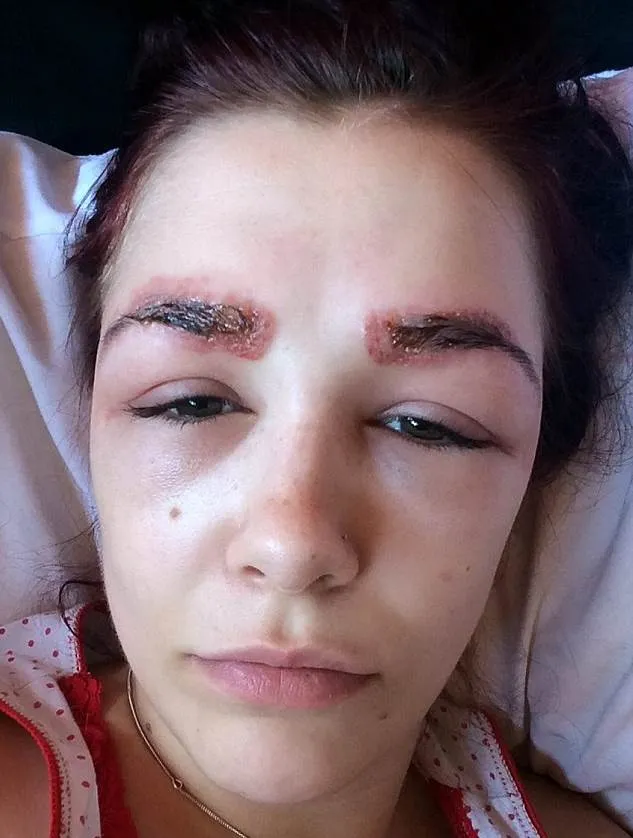 Алергія на очах як виглядає, як лікувати і запобігати виникненню (алергія) Алергія на очах як виглядає, як лікувати і запобігати виникненню