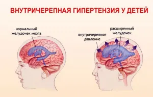 Болить біля ока причини, захворювання, лікування, наслідки (захворювання) Болить біля ока причини, захворювання, лікування, наслідки