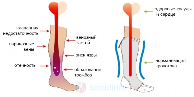 Для чого потрібна компресійна одяг в спорті (рашгарди) Для чого потрібна компресійна одяг в спорті