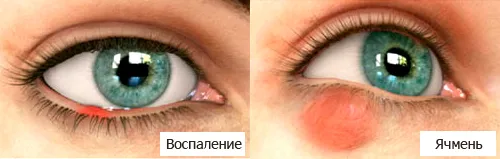 Очні краплі з антибіотиком застосування, список (антибіотиком) Очні краплі з антибіотиком застосування, список