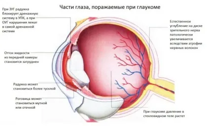 Перші ознаки глаукоми очі - симптоми, види та лікування (перші) Перші ознаки глаукоми очі - симптоми, види та лікування