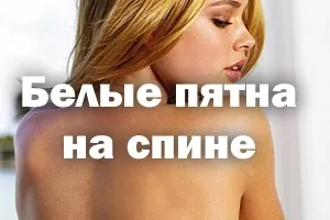 Білі плями на спині після засмаги, лікування, грибок, як позбутися і шкірі (білі) Білі плями на спині після засмаги, лікування, грибок, як позбутися і шкірі