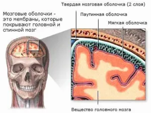 Інфекційні захворювання головного мозку - симптоми і лікування (головного) Інфекційні захворювання головного мозку - симптоми і лікування
