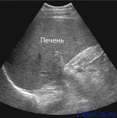 Як часто можна робити узі черевної порожнини (черевної) Як часто можна робити узі черевної порожнини