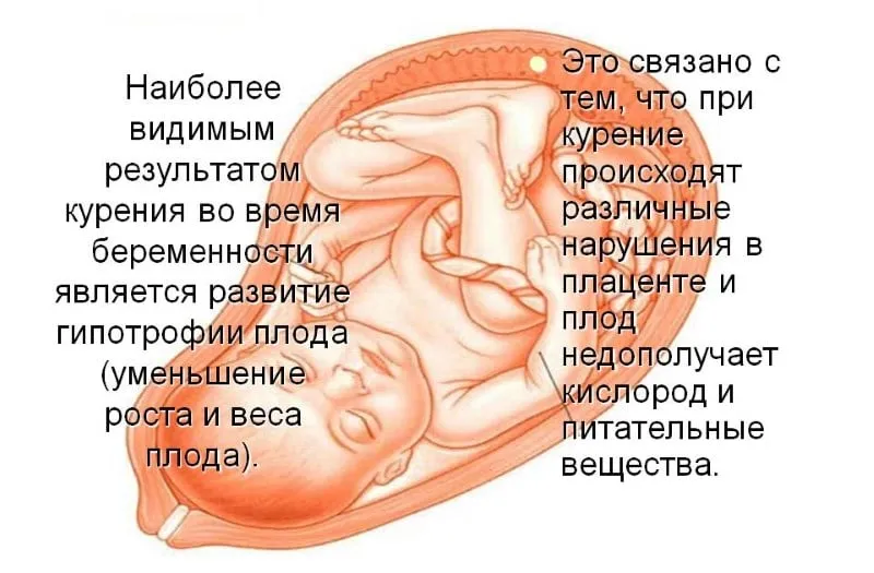 Як кинути курити при вагітності (кинути) Як кинути курити при вагітності