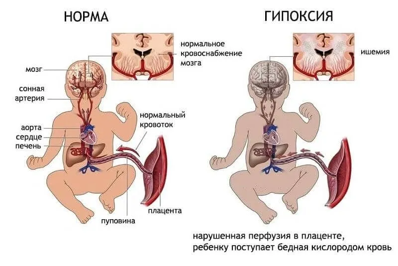 Як кинути курити при вагітності (вагітності) Як кинути курити при вагітності