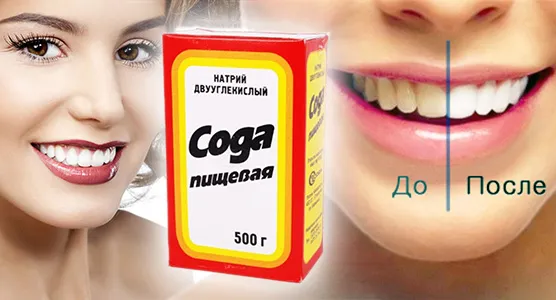 Як відбілити зуби содою в домашніх умовах можна відбілити харчовою содою (відбілити) Як відбілити зуби содою в домашніх умовах можна відбілити харчовою содою