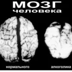 Як мотивувати алкоголіка лікуватися, що зробити щоб алкоголік лікувався (Лікування залежностей важкий) Як мотивувати алкоголіка лікуватися, що зробити щоб алкоголік лікувався