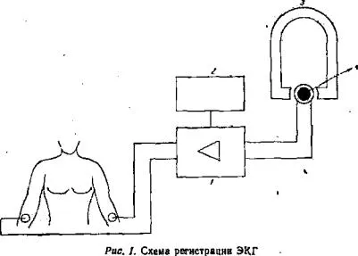 клінічна електрокардіографія