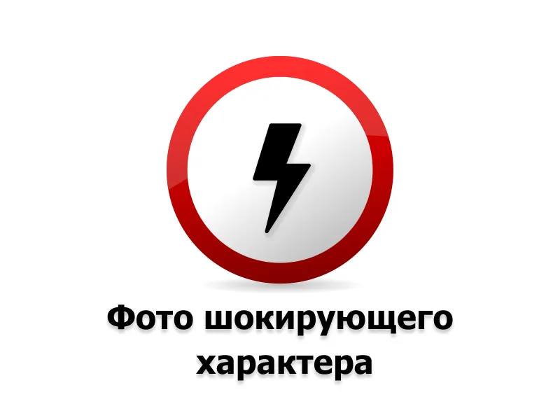 Крипторхізм у дітей операція, відгуки та вартість лікування