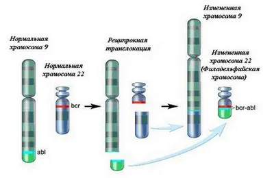 Лейкоз причини, форми, симптоми і діагностика (діагностика) Лейкоз причини, форми, симптоми і діагностика
