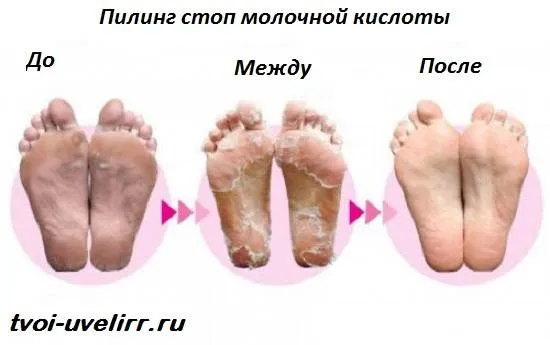 Молочна кислота 2