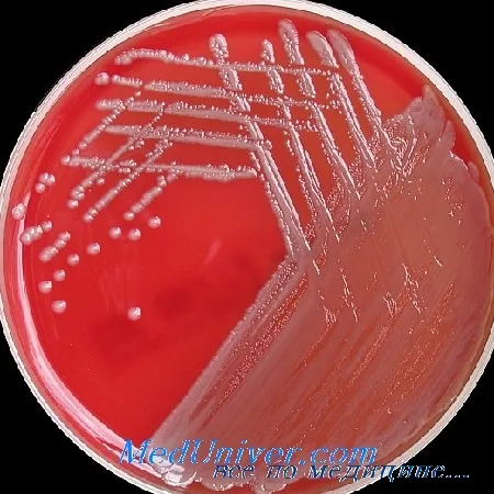 Неферментуючі грамнегативні палички роду acinetobacter як причина ранових інфекцій