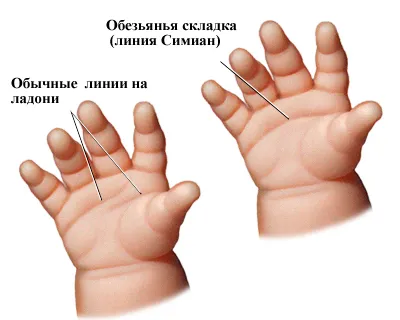 мавпяча складка