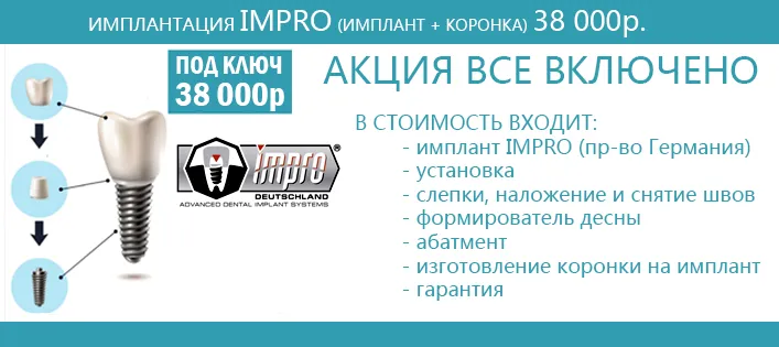 Ускладнення після імплантації зубів, біль, оніміння, втрата чутливості (після) Ускладнення після імплантації зубів, біль, оніміння, втрата чутливості