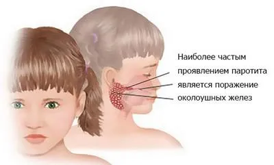 Патології, при яких болить шия з правого боку (сторони) Патології, при яких болить шия з правого боку