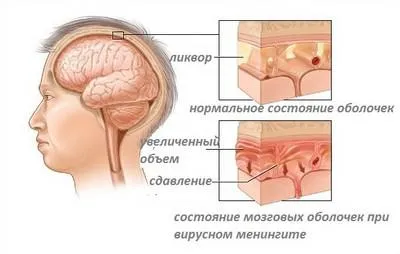 Патології, при яких болить шия з правого боку (сторони) Патології, при яких болить шия з правого боку