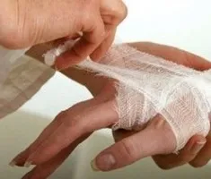 Чому рани довго заживають рецепти здоров'я (заживають) Чому рани довго заживають рецепти здоров'я
