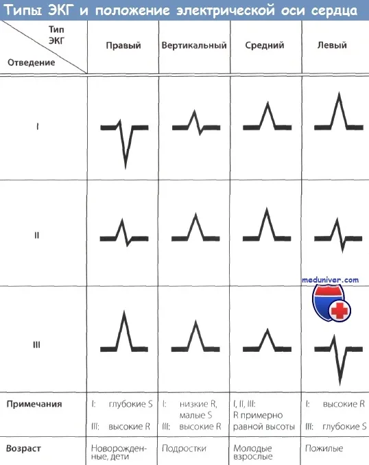 Поняття про електричну позиції серця (електричної) Поняття про електричну позиції серця