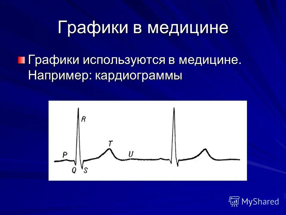Презентація на тему графіки що таке графіки графіки - це показ кількісних даних (це показ кількісних даних. Вони описують або підсумовують набір цифр або статистику. Графіки) Презентація на тему графіки що таке графіки графіки - це показ кількісних даних