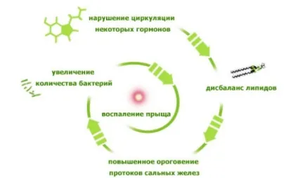 Чим відрізняються вугри від прищів класифікація, ступеня тяжкості, особливості лікування, фото (лікування) Чим відрізняються вугри від прищів класифікація, ступеня тяжкості, особливості лікування, фото