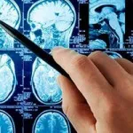 Сильні головні болі в області чола, очей, скронь у дітей і дорослих причини і лікування (головний біль в області чола і очей) Сильні головні болі в області чола, очей, скронь у дітей і дорослих причини і лікування