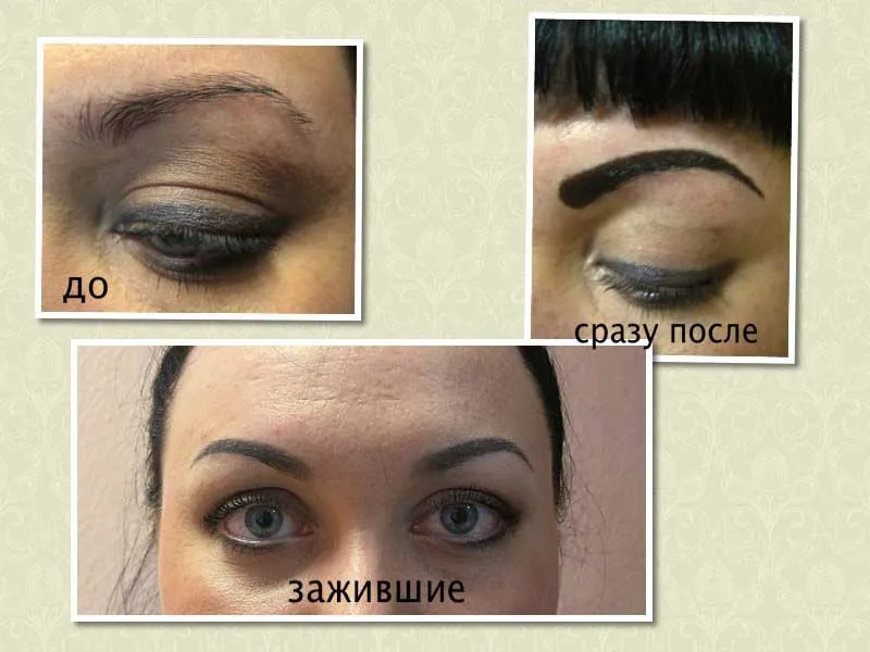 Шотірованіе брів фото до і після загоєння, техніка перманентниого макіяжу