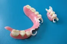 Термопласт - нововведення в знімному протезуванні - dentalfabrik (найманому) Термопласт - нововведення в знімному протезуванні - dentalfabrik