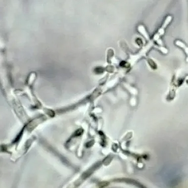 Trichophyton rubrum (трихофітон червоний)