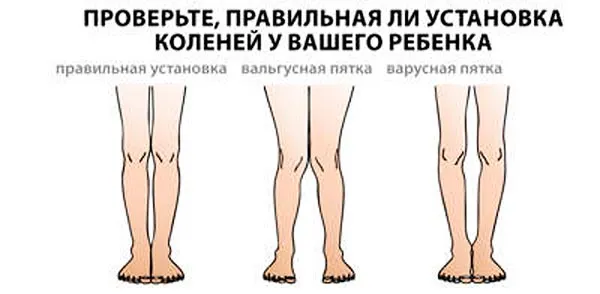Туге сповивання новонародженого (фото і відео) (місяці життя малюка) Туге сповивання новонародженого (фото і відео)