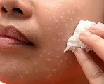 Чим вугри відрізняються від прищів препарати від вугрової висипки (вугрової) Чим вугри відрізняються від прищів препарати від вугрової висипки