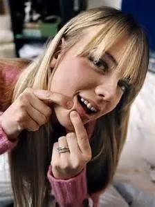 Чим вугри відрізняються від прищика, як позбутися від прищів в домашніх умовах (через що з'являються прищі) Чим вугри відрізняються від прищика, як позбутися від прищів в домашніх умовах