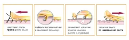 Сверблять ноги після гоління що робити (сверблять ноги гоління епілятор чому мазати) Сверблять ноги після гоління що робити