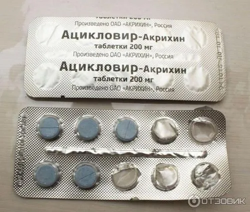 Вітрянка у дітей лікування ацикловіром відгуки, вітрянка у дітей (дітей) Вітрянка у дітей лікування ацикловіром відгуки, вітрянка у дітей