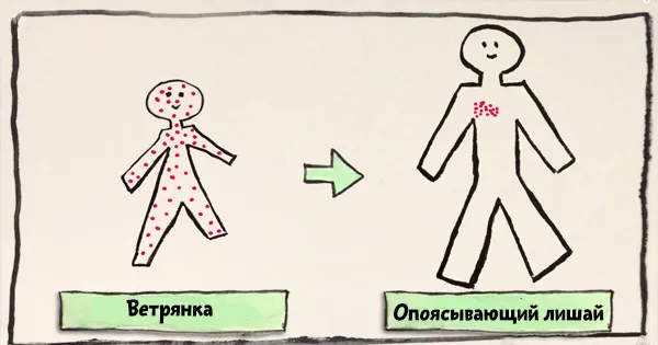 вірус герпесу
