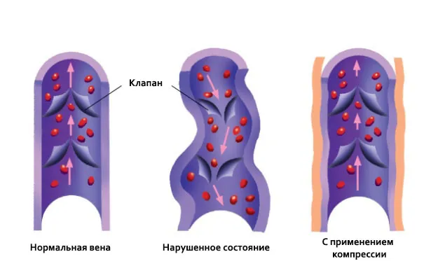Навіщо вам компрессионная спортивний одяг - зожнік (одяг) Навіщо вам компрессионная спортивний одяг - зожнік
