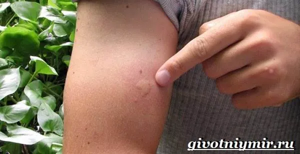 жигалка муха