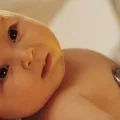Алергія - як лікувати алергію, статті про різні види алергічних реакцій (алергія) Алергія - як лікувати алергію, статті про різні види алергічних реакцій