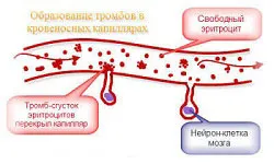 Алкоголь розширює судини користь і шкода (алкоголь розширює судину серце мозок) Алкоголь розширює судини користь і шкода