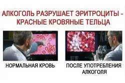 Алкоголь розширює судини користь і шкода (алкоголь) Алкоголь розширює судини користь і шкода