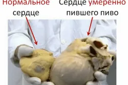 Алкоголь розширює судини користь і шкода (алкоголь розширює судину серце мозок) Алкоголь розширює судини користь і шкода