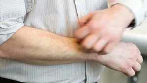 Алергія на сою - причини, симптоми і лікування (лікування) Алергія на сою - причини, симптоми і лікування